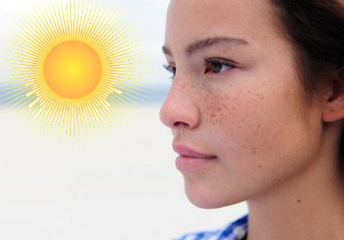 Các bệnh về da do ánh nắng mặt trời | Vinmec