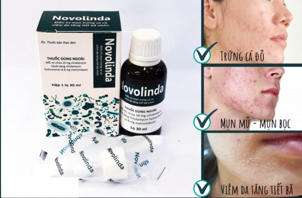 Công dụng của Novolinda chấm mụn viêm